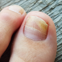 DERMATOLOGICKÉ INFORMÁCIE!