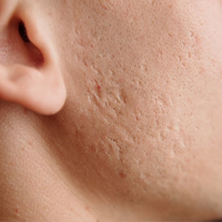 DERMATOLOGICKÉ INFORMÁCIE!