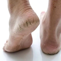 DERMATOLOGICKÉ INFORMÁCIE!