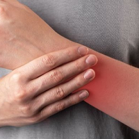 DERMATOLOGICKÉ INFORMÁCIE!
