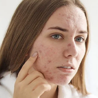 DERMATOLOGICKÉ INFORMÁCIE!