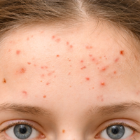 DERMATOLOGICKÉ INFORMÁCIE!