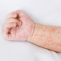 DERMATOLOGICKÉ INFORMÁCIE!